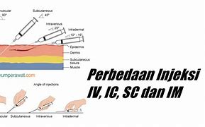 Injeksi Im Adalah